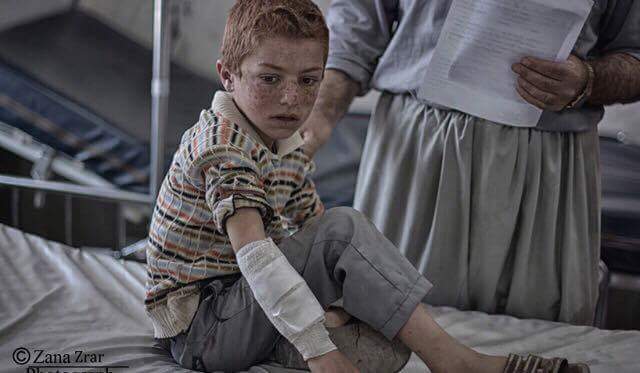 بالصور.. جرحى القصف الايراني على قرى حدودية باقليم كوردستان